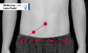 MODUL 5. Untersuchung des Abdomens – U-Kurs