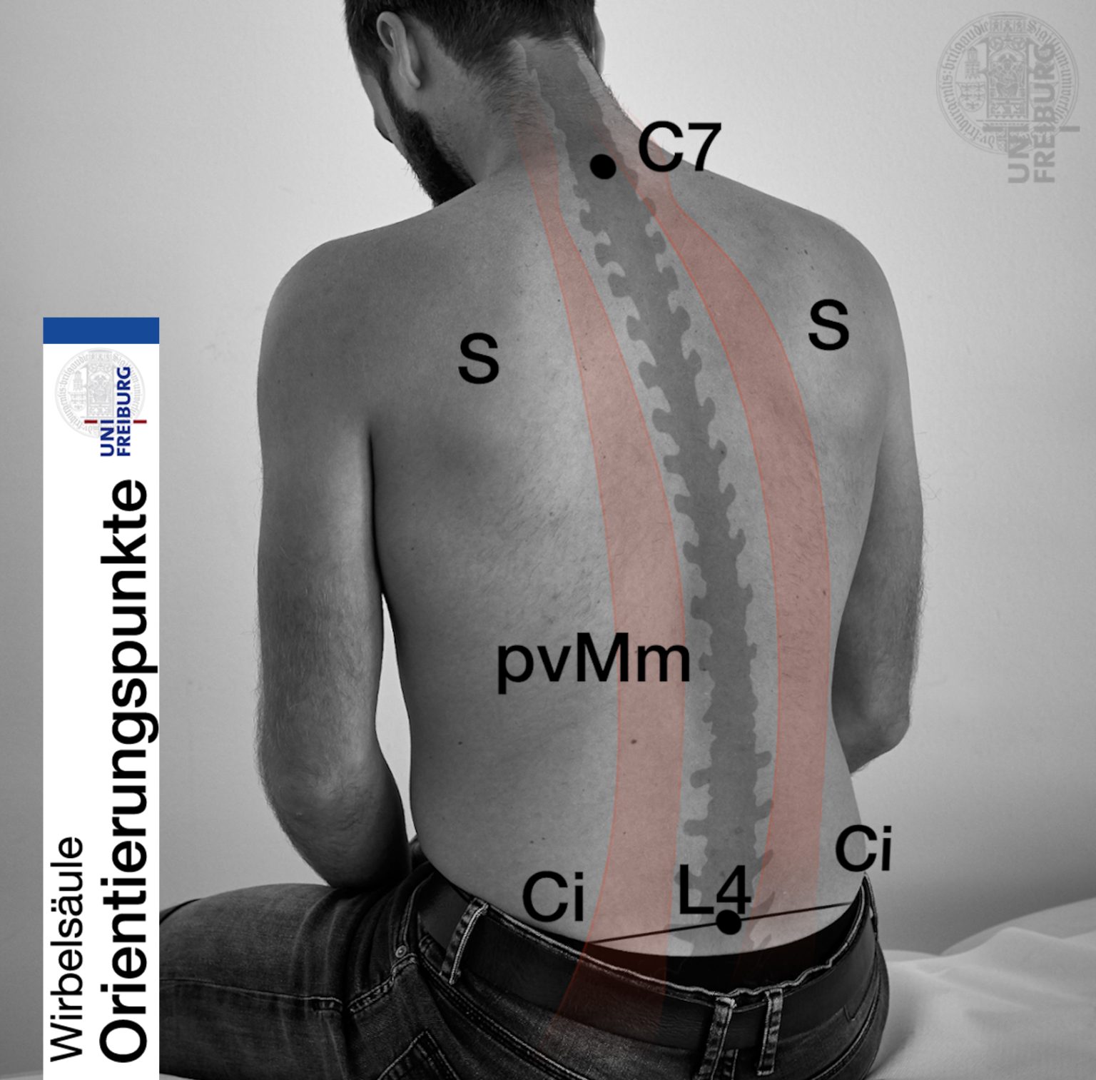6.1 Untersuchung der Wirbelsäule UKurs